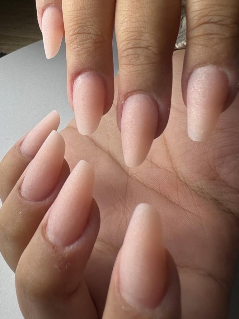 Lova Nail System